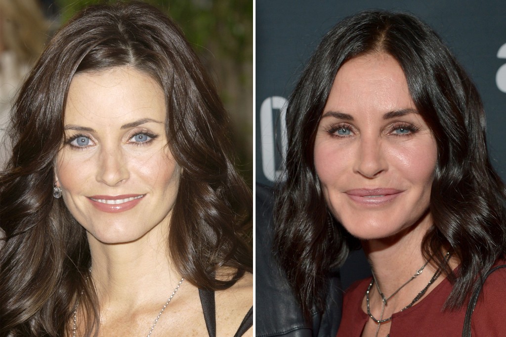 As a milestone birthday nears, TV legend Courteney Cox, 47, is done with fillers: 
