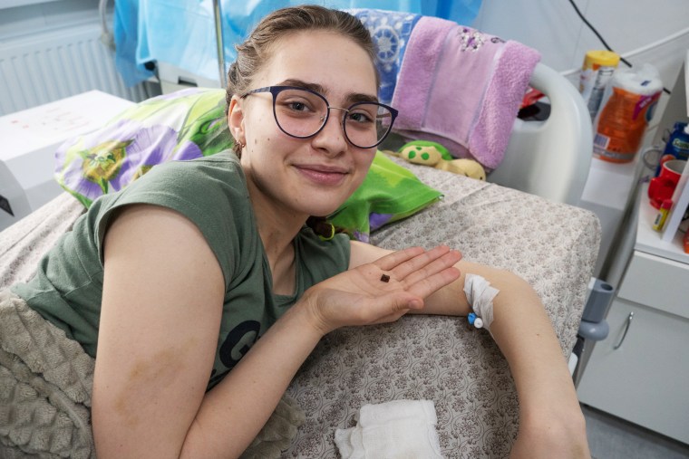 Kira Seroshtan holds a piece of metal removed from her body after she was struck by shrapnel following Russian shelling of Kharkiv.