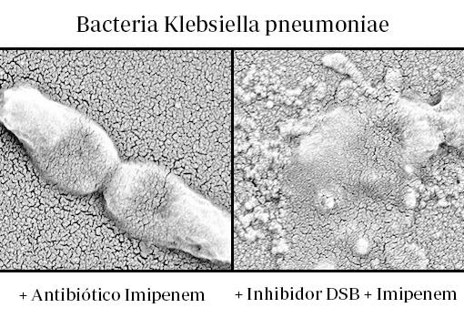 On the left, a super-resistant bacterium survives the action of the antibiotic.  On the right, the bacterium dies after using an inhibitor of the DsbA protein and the antibiotic Imipenem, as shown in the study by Dr. Mavridou
